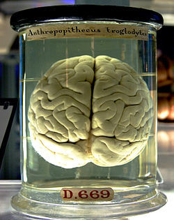 250px-Chimp_Brain_in_a_jar.jpg