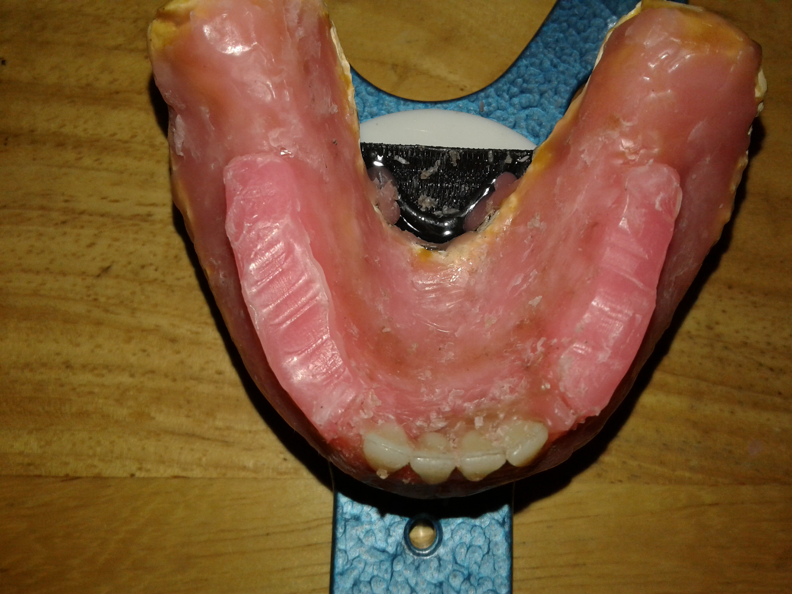 DentureInstructable013.jpg