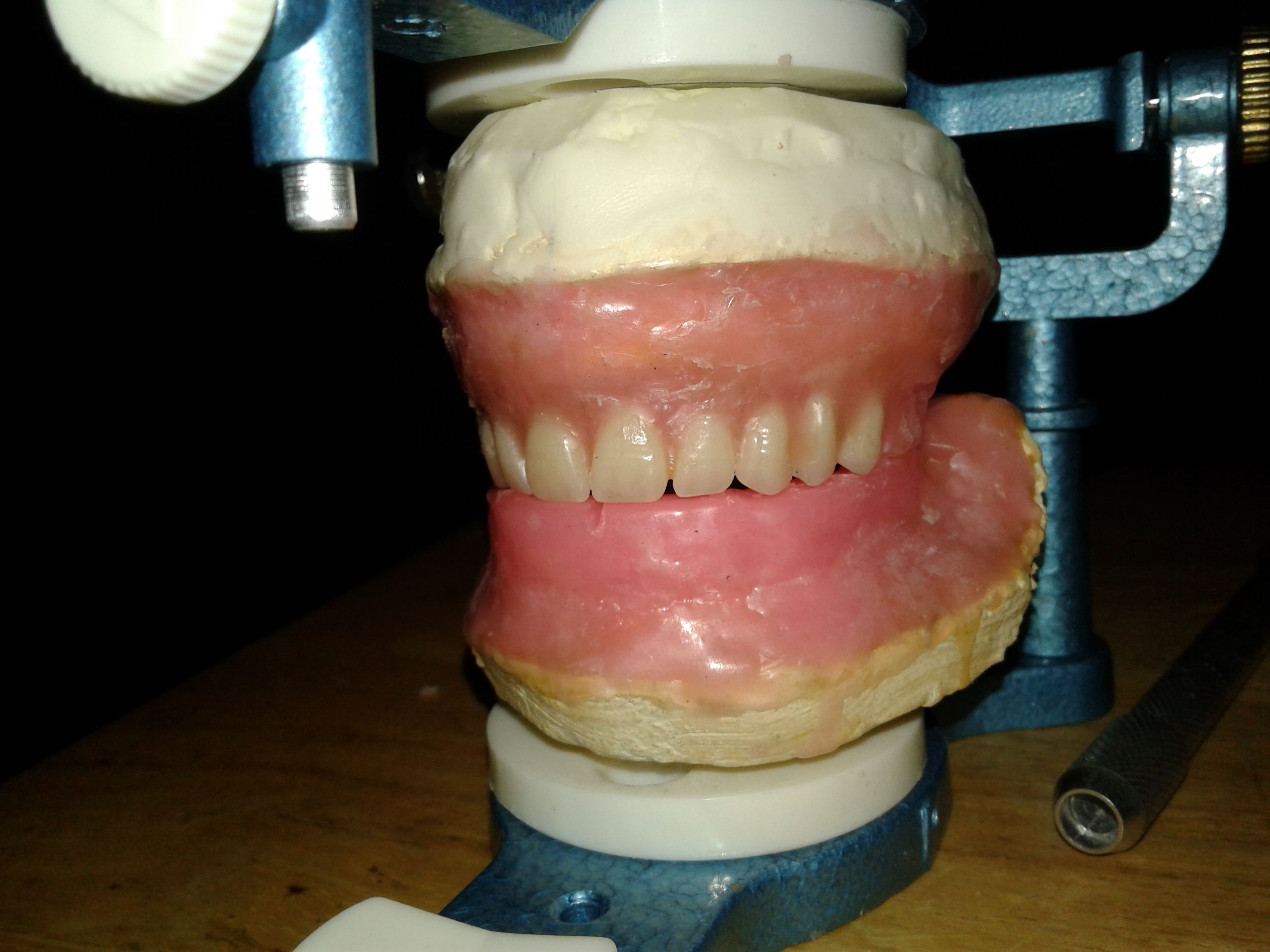 DentureInstructable015.jpg