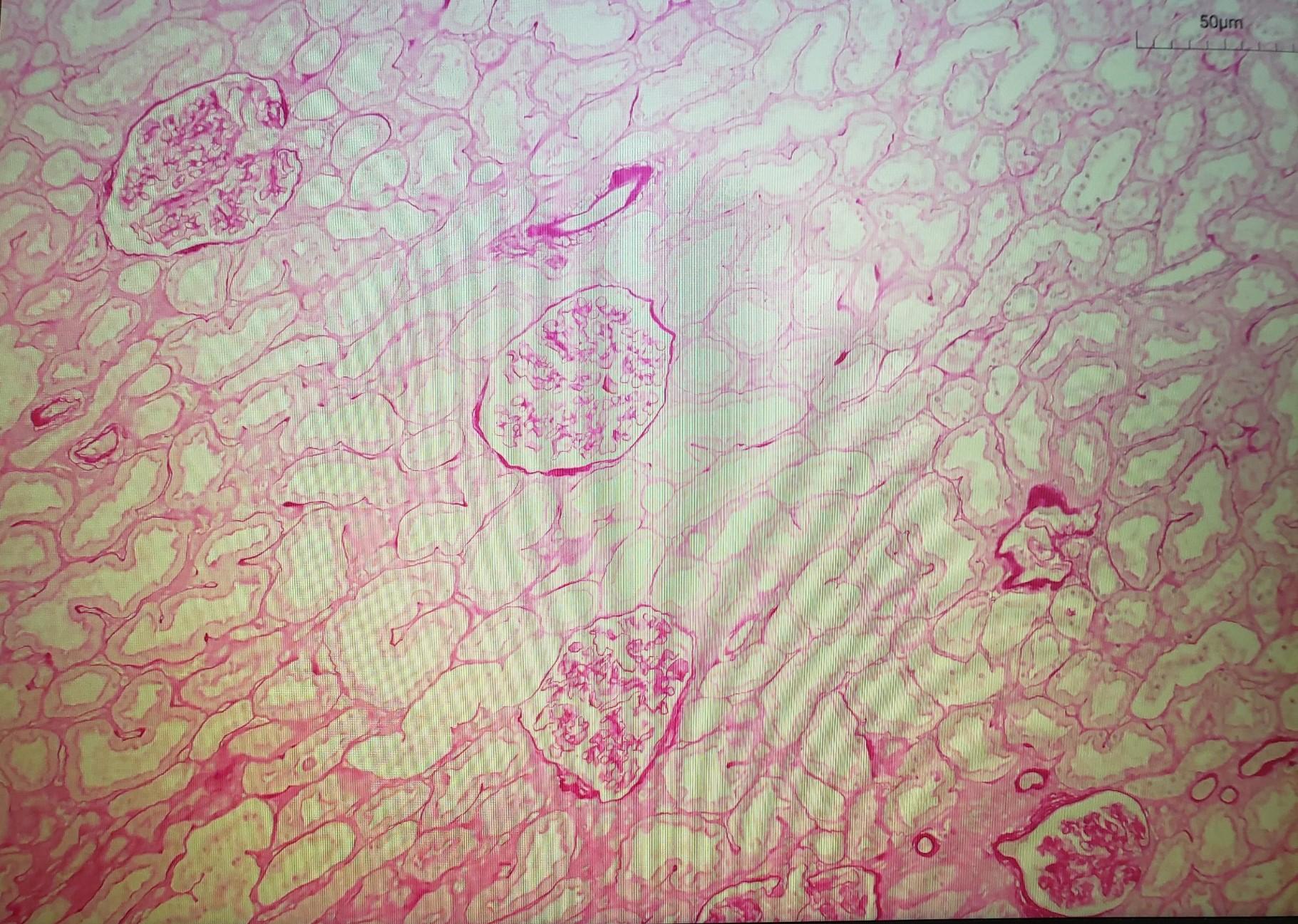 H&amp;E Minus Hematoxylin.jpeg