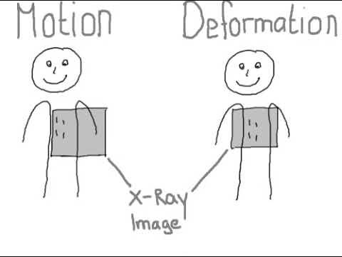 Motion vs Deformation