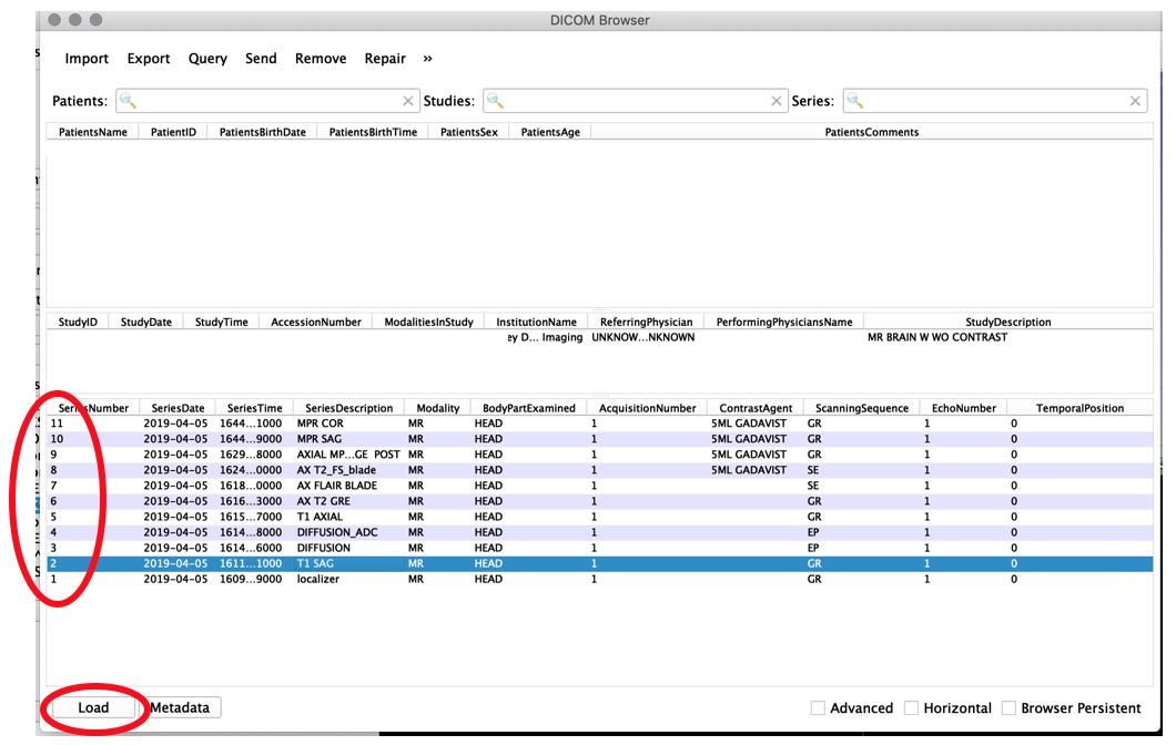 Slide5-LoadAllFiles.jpg