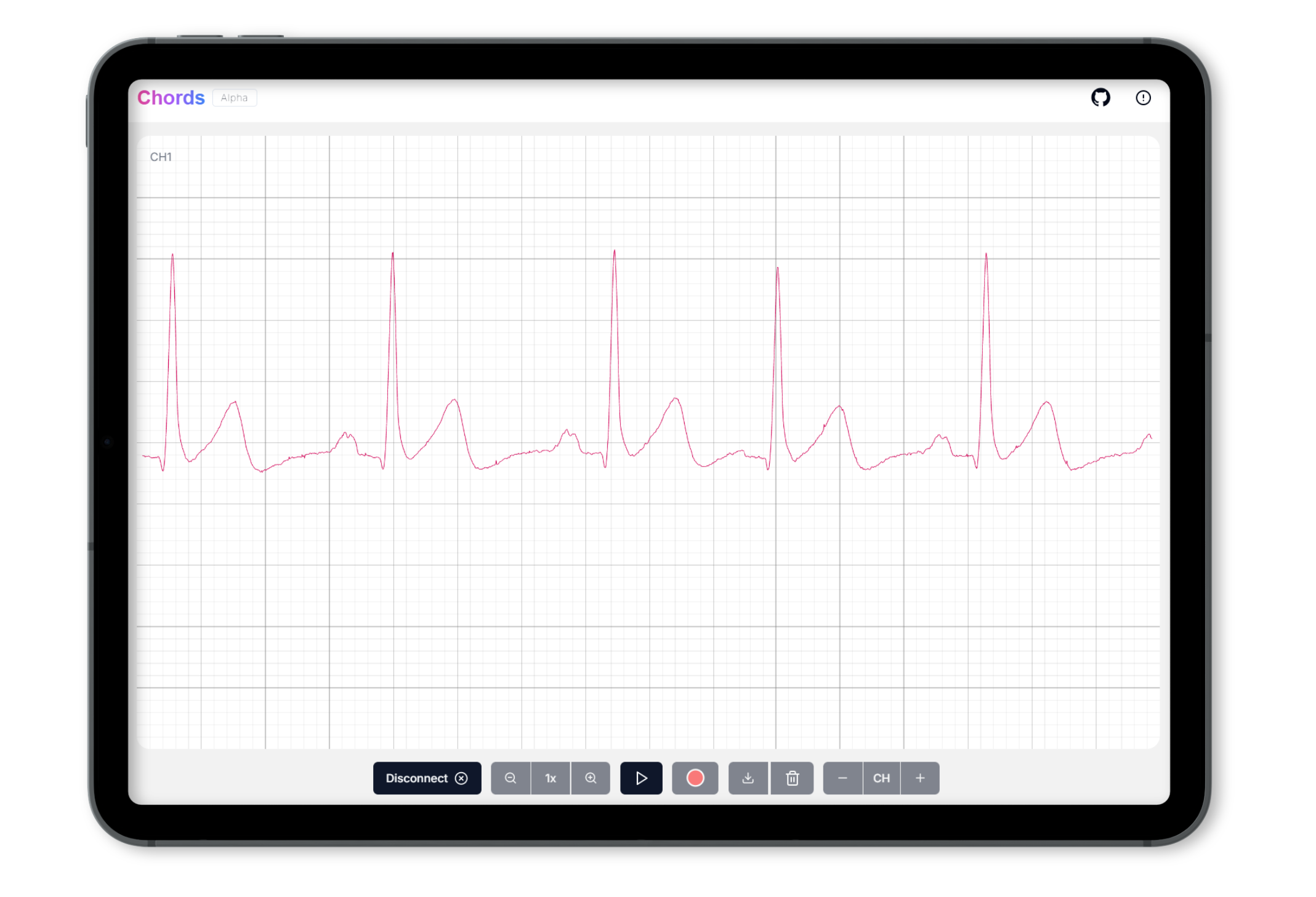 ecg-signals-using-candy-new.png