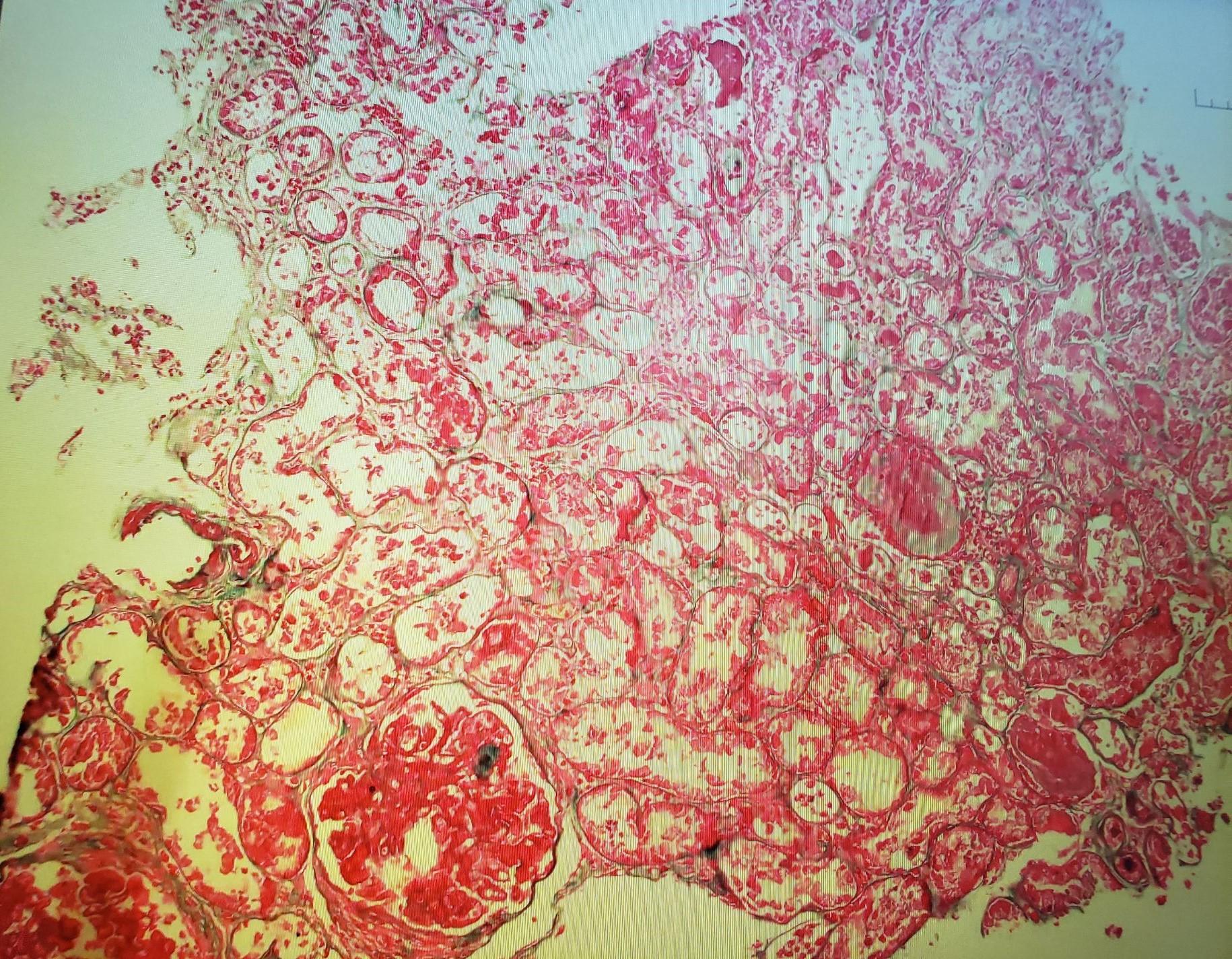 trichome, with wrong reagent used in stain.jpeg