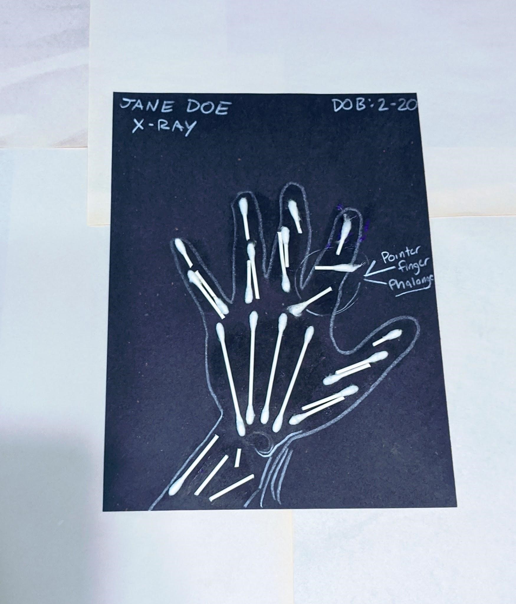 xray8.jpg